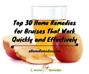 Read more about the article Top 30 Effective Home Remedies for Bruises