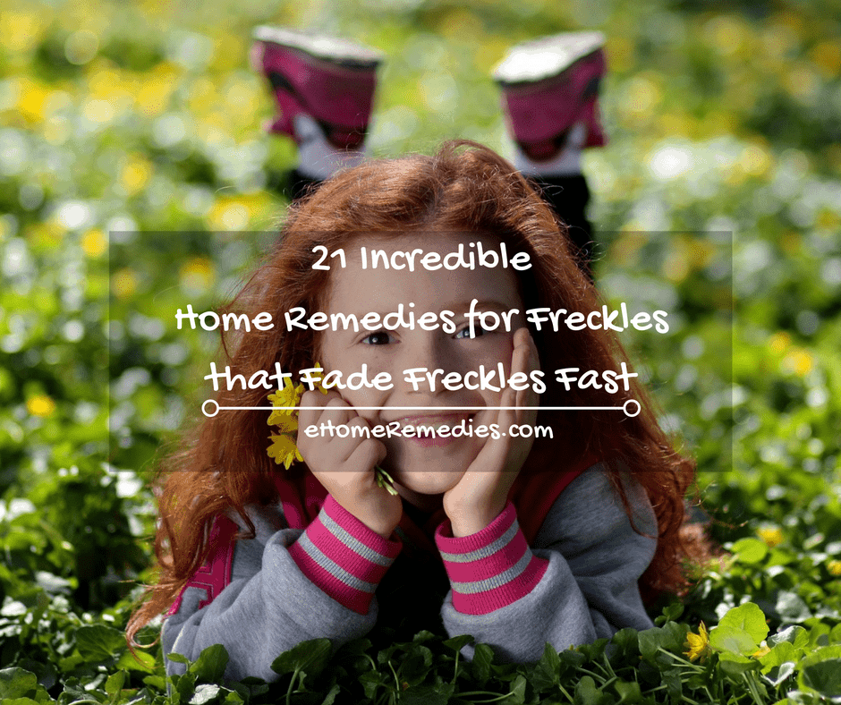 21 Incredible Home Remedies for Freckles that Fade Freckles Fast
