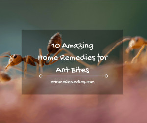 Read more about the article 10 Amazing Home Remedies for Ant Bites