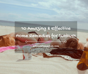 Read more about the article 10 Amazing & Effective Home Remedies for Sunburn