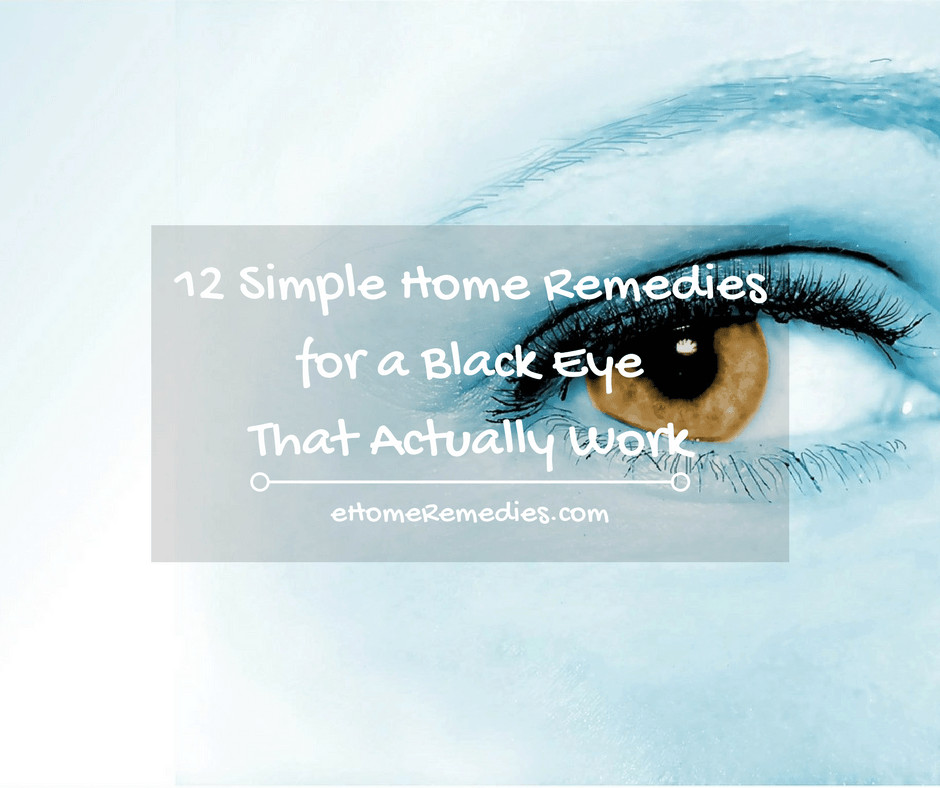 12 Simple Home Remedies for a Black Eye That Actually Work