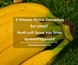 Read more about the article 5 Proven Home Remedies For Wart That Will Save You From Embarrassment