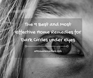 Read more about the article 9 Best and Most Effective Home Remedies for Dark Circles under Eyes