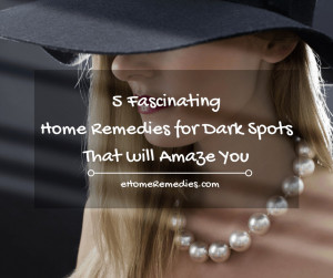 5 Fascinating Home Remedies for Dark Spots That will Amaze You
