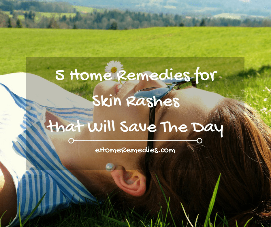 Read more about the article 5 Home Remedies for Skin Rashes that Will Save The Day