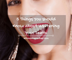 Read more about the article 5 Things You should Know about Whitening Your Teeth