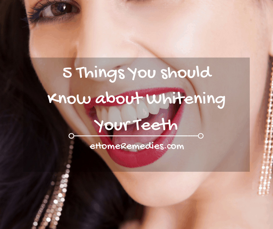 5 Things you should know about whitening your teeth