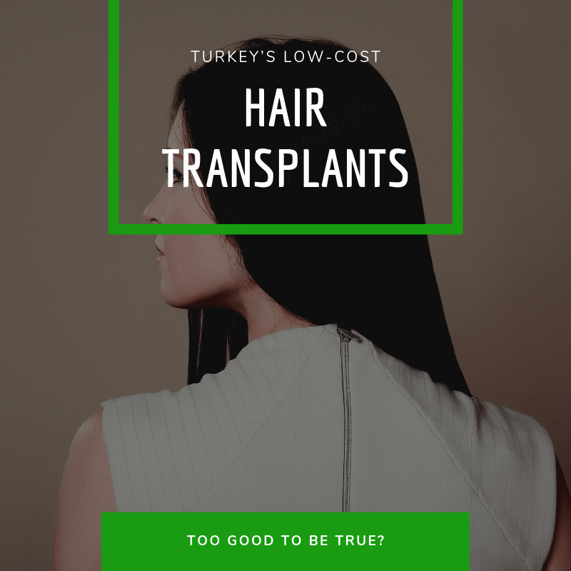 Turkeys Low Cost Hair Transplants