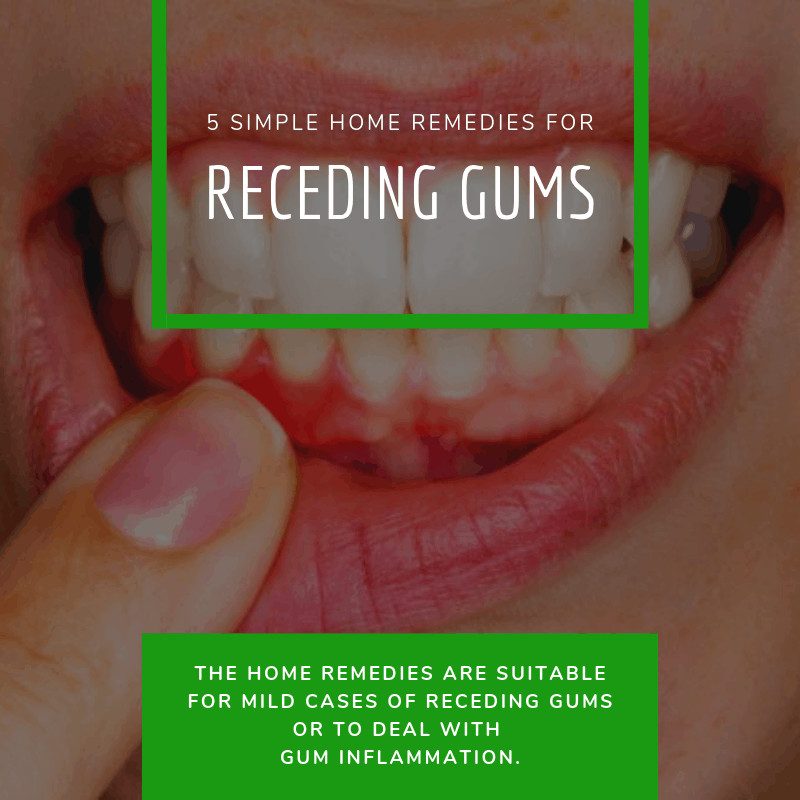 Home Remedies for Receding Gums