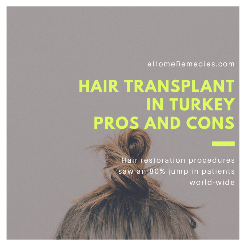 Hair Transplant In Turkey Pros and Cons