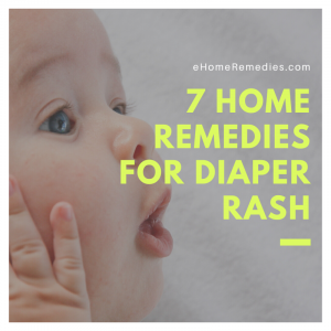 Read more about the article 7 Home Remedies For Diaper Rash