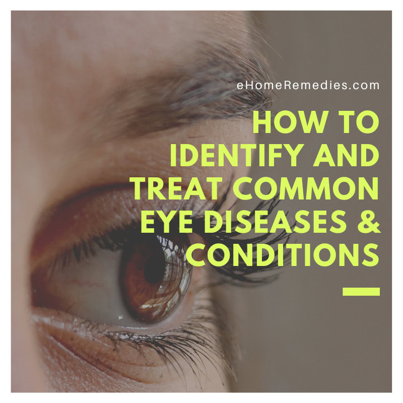 How To Identify and Treat Common Eye Diseases Conditions