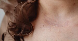 Read more about the article Best Herbs For Skin Regeneration: Spa-Quality Results With Edible Ingredients