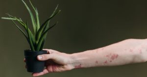 Read more about the article 20 Home Remedies for Carpal Tunnel Syndrome: Science-Backed Herbal and Holistic Relief