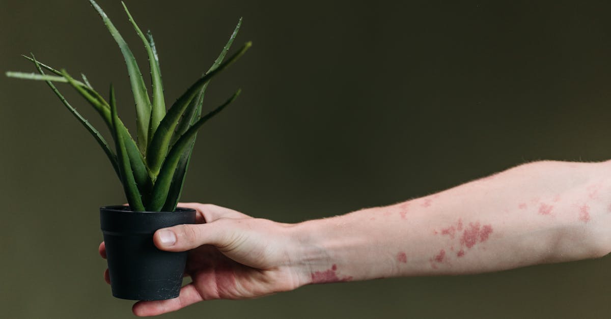 You are currently viewing 20 Home Remedies for Carpal Tunnel Syndrome: Science-Backed Herbal and Holistic Relief