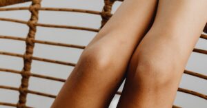 Read more about the article 20 Home remedies for dark elbows and knees: How to Lighten Dark Elbows and Knees Naturally: A Science-Backed Herbal Guide