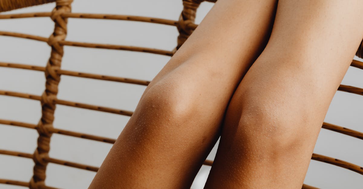 Read more about the article 20 Home remedies for dark elbows and knees: How to Lighten Dark Elbows and Knees Naturally: A Science-Backed Herbal Guide