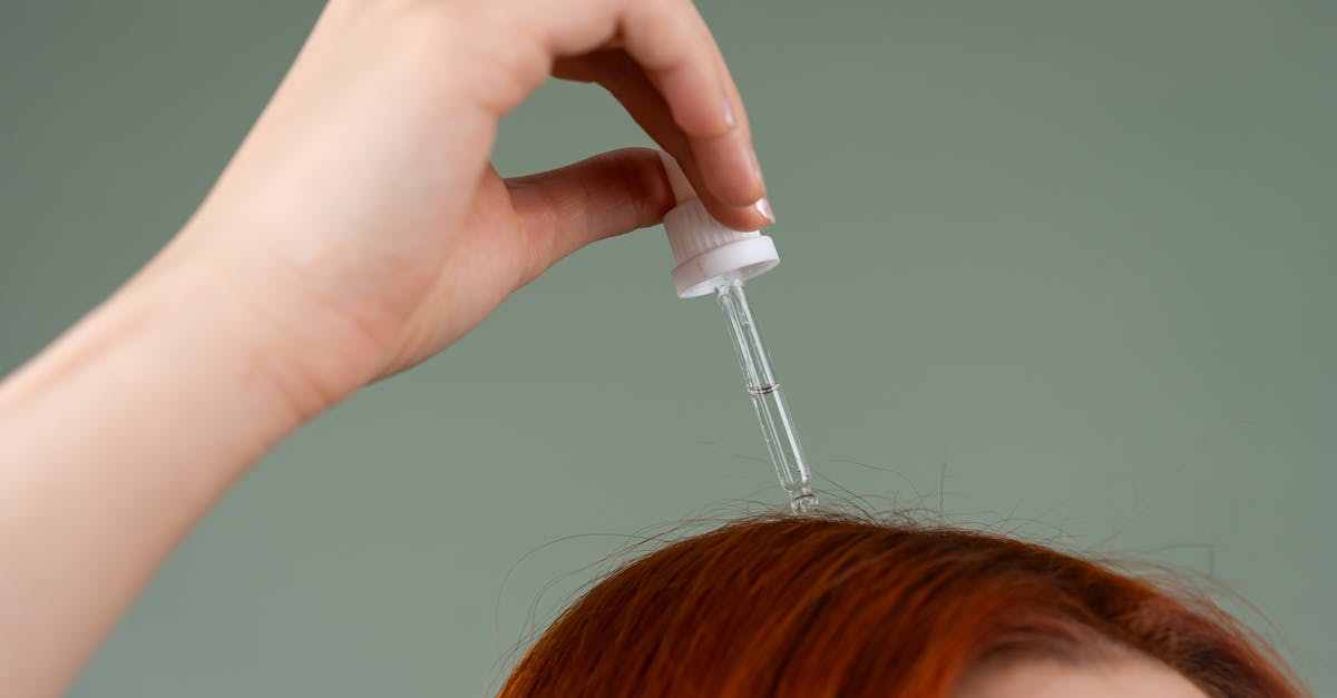 Read more about the article Natural Healing for Your Scalp: A Biblical and Herbal Guide to 16 Home Remedies for Scalp Folliculitis